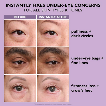 Instant Eye Lift Gel + FREE Brush by VIMVY™