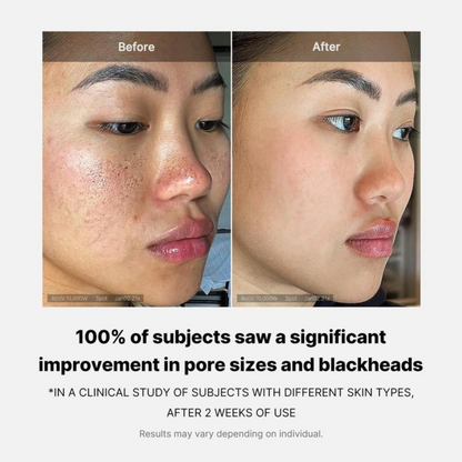 GlassGlow™ Pads by VIMVY